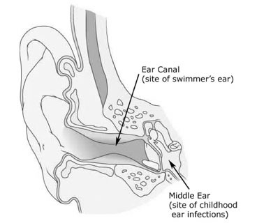 Middle Ear Infections and Swimmer's Ear